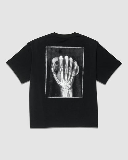 X-Ray Tee