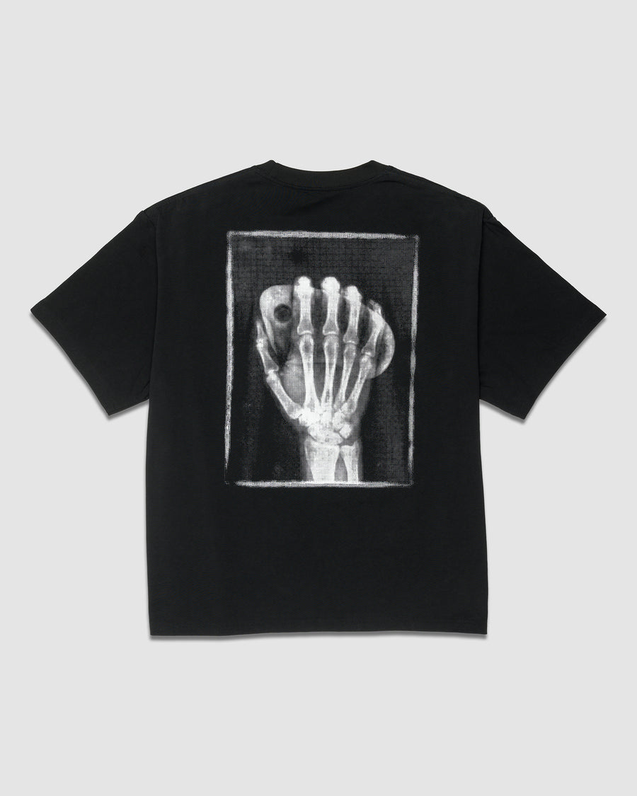X-Ray Tee