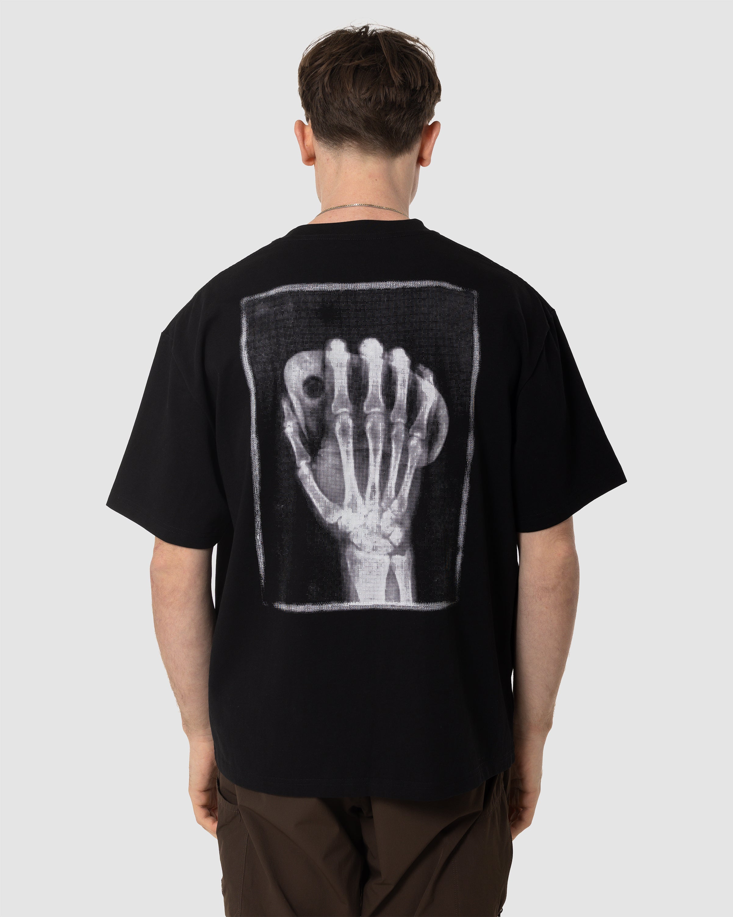 X-Ray Tee – Rúngne
